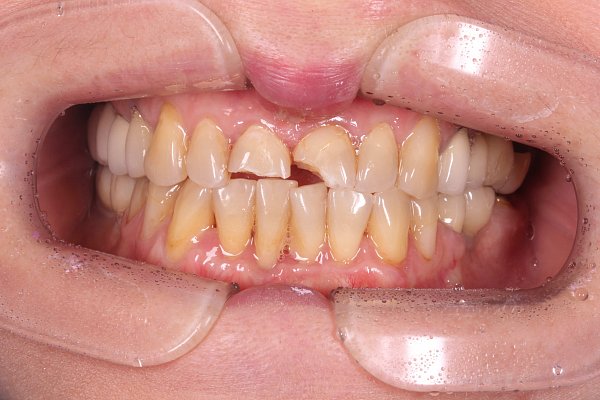 Лечение зубов в рассрочку ярославль