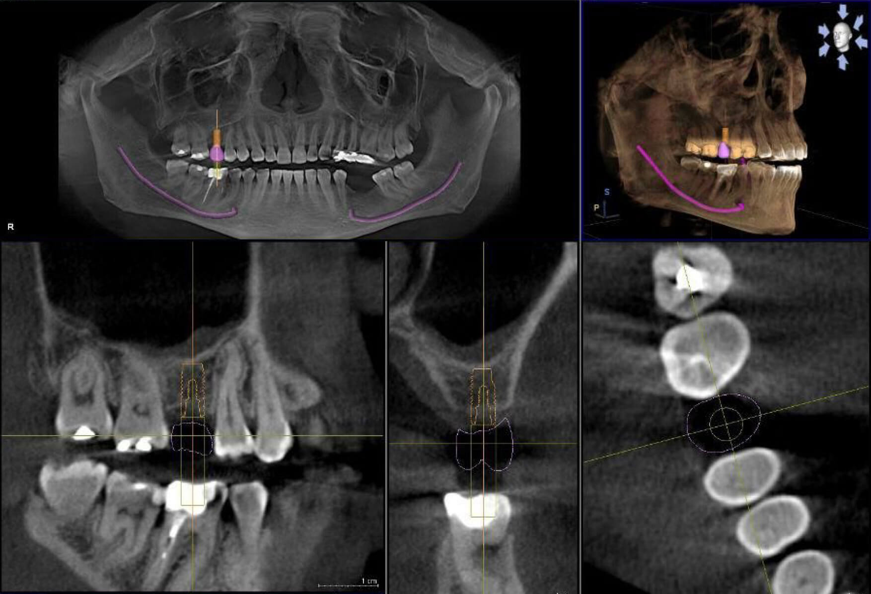 Кт д т. Компьютерная томография челюстей VATECH. Аппарат для 3д рентгена челюсти.