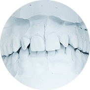 Распорка для рта при лечении зубов thumbnail
