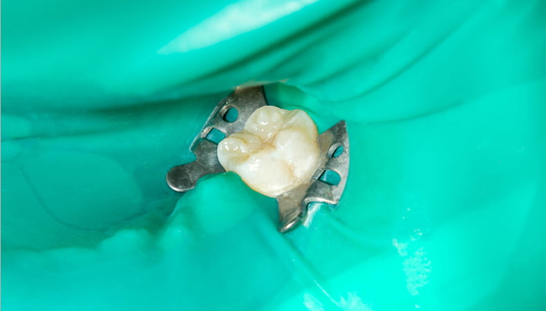Срочное лечение зубов ярославль
